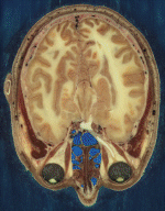 head section