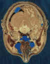 head section
