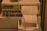 Baby HR monitor