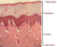 thick skin